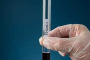 Covid-19: tornano a crescere i casi in Italia