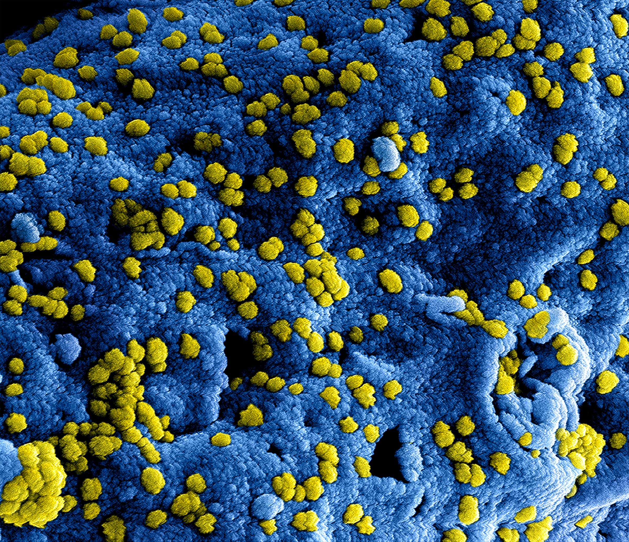 Hantavirus: che cos’è, come si trasmette e perché la prevenzione è fondamentale