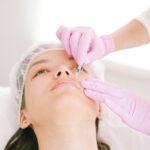 Filler, stretta del Ministero: cosa cambia davvero? Intervista alla Dottoressa Laura Mazzotta